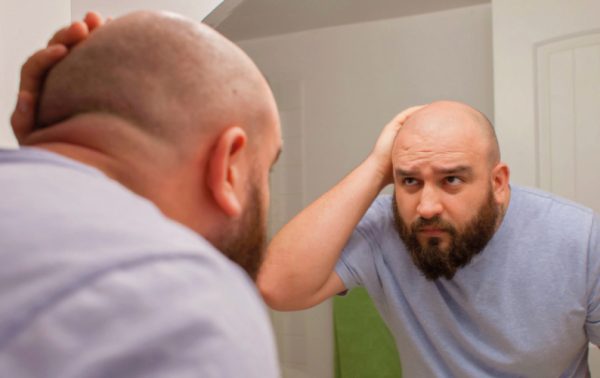Um homem está se olhando no espelho. Ele está com toda a cabeça raspada, é calvo, tem barba e está vestindo uma camiseta azul clara. Ele está preocupado com a queda de cabelo, passando a mão sobre sua cabeça.